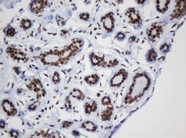 DCPS Antibody in Immunohistochemistry (Paraffin) (IHC (P))