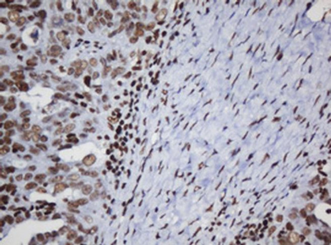 DCPS Antibody in Immunohistochemistry (Paraffin) (IHC (P))