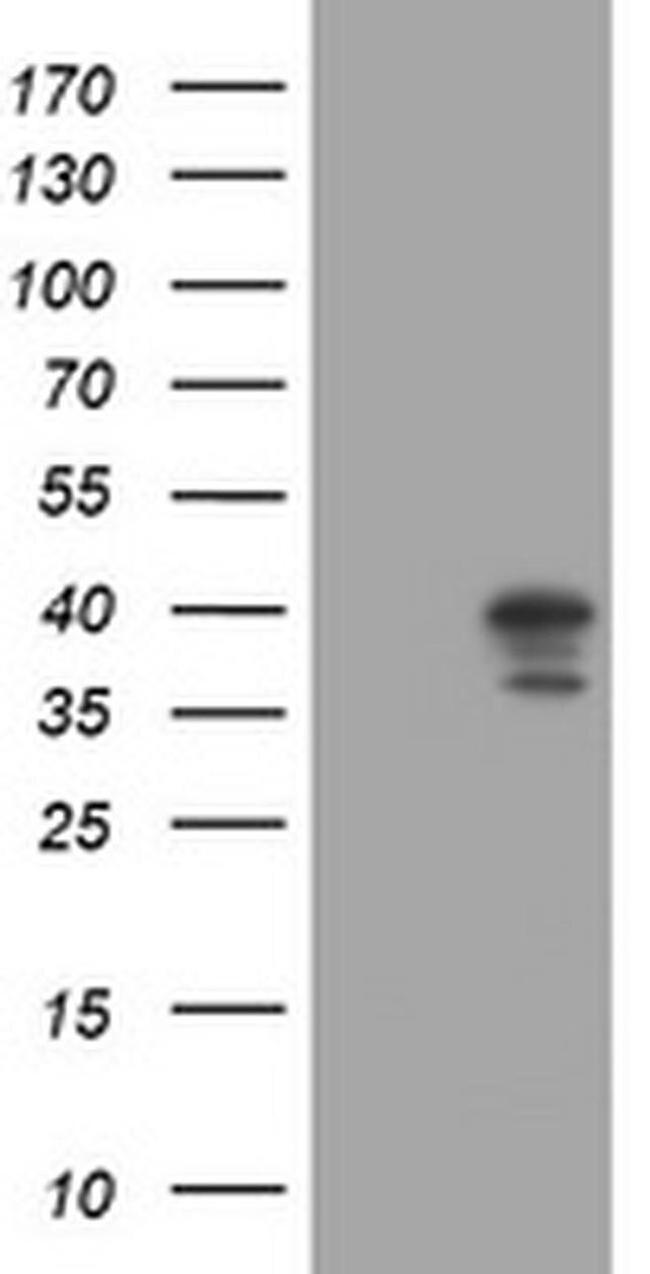 DCPS Antibody in Western Blot (WB)