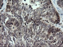 KIF25 Antibody in Immunohistochemistry (Paraffin) (IHC (P))