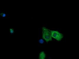 NR1 Antibody in Immunocytochemistry (ICC/IF)