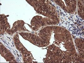 NR1 Antibody in Immunohistochemistry (Paraffin) (IHC (P))