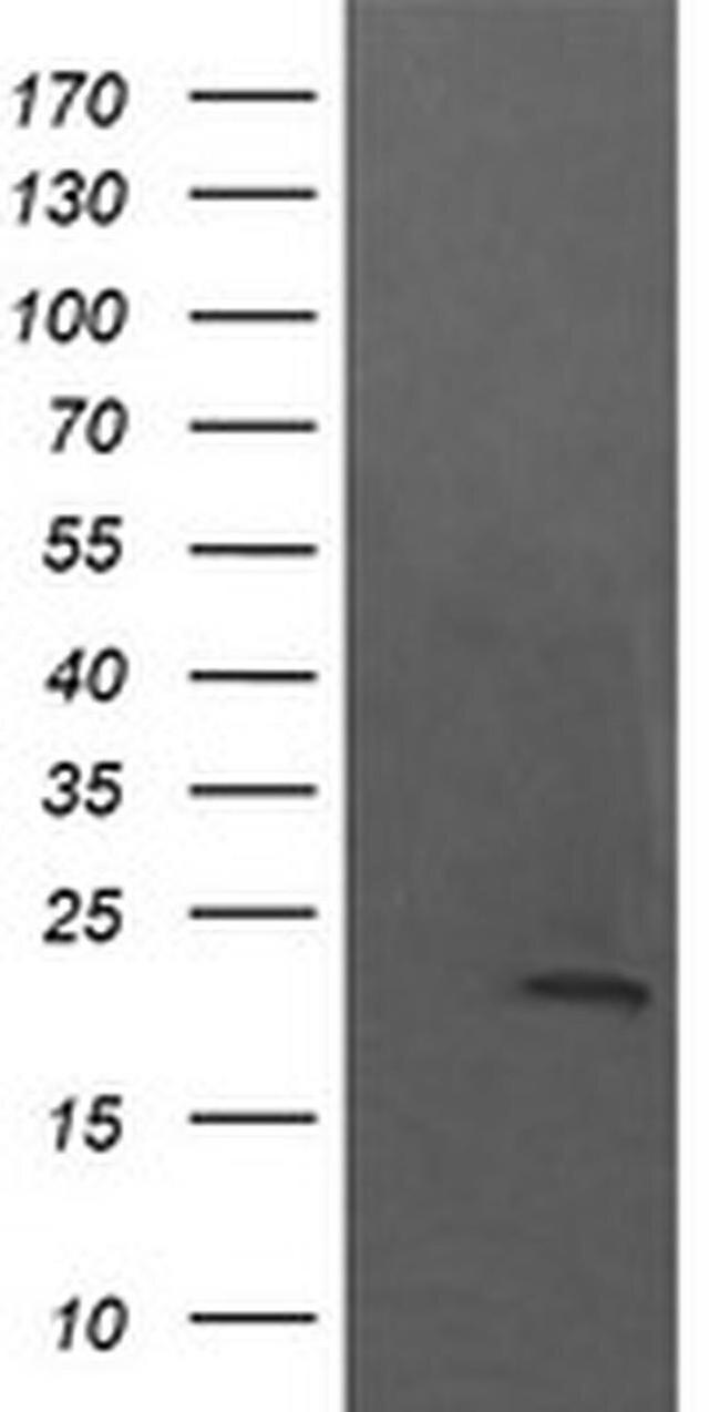 KappaB ras1 Antibody in Western Blot (WB)