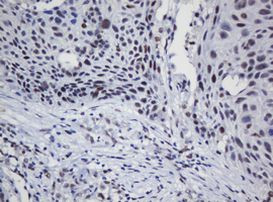 TRMT2A Antibody in Immunohistochemistry (Paraffin) (IHC (P))