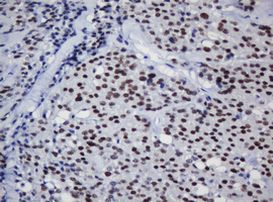 TRMT2A Antibody in Immunohistochemistry (Paraffin) (IHC (P))