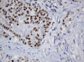 TRMT2A Antibody in Immunohistochemistry (Paraffin) (IHC (P))