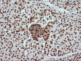 TRMT2A Antibody in Immunohistochemistry (Paraffin) (IHC (P))