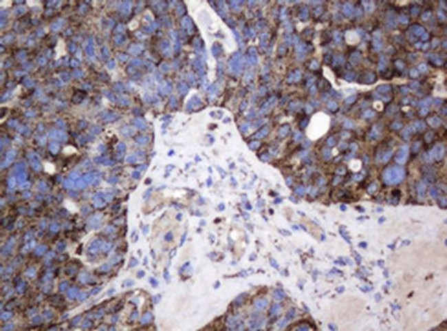 GLB1 Antibody in Immunohistochemistry (Paraffin) (IHC (P))