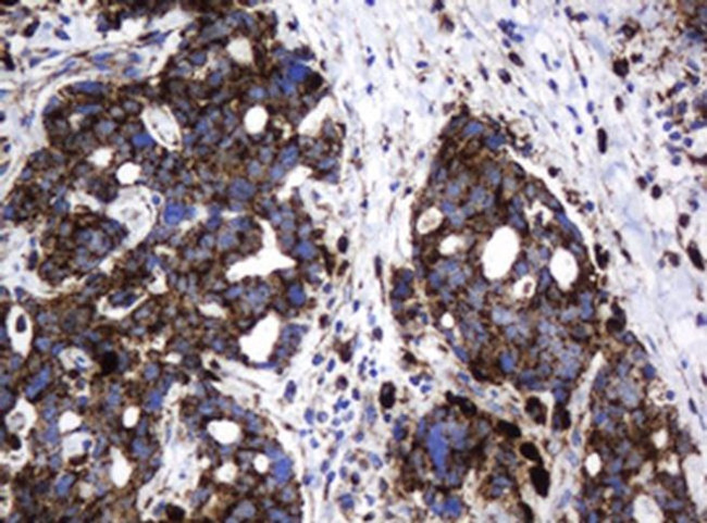 GLB1 Antibody in Immunohistochemistry (Paraffin) (IHC (P))