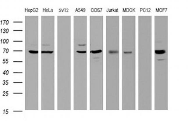 GLB1 Antibody in Western Blot (WB)