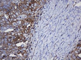 TAPBPL Antibody in Immunohistochemistry (Paraffin) (IHC (P))