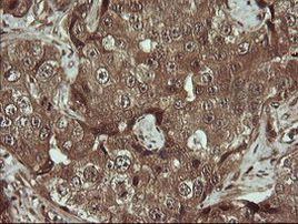 TRMT2A Antibody in Immunohistochemistry (Paraffin) (IHC (P))