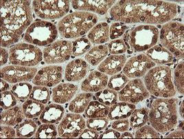 TRMT2A Antibody in Immunohistochemistry (Paraffin) (IHC (P))