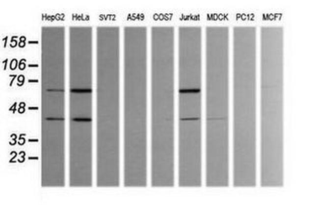 TRMT2A Antibody in Western Blot (WB)