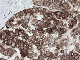 TAPBPL Antibody in Immunohistochemistry (Paraffin) (IHC (P))