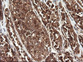 TAPBPL Antibody in Immunohistochemistry (Paraffin) (IHC (P))