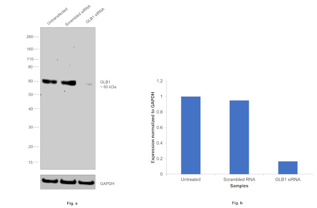 GLB1 Antibody in Western Blot (WB)