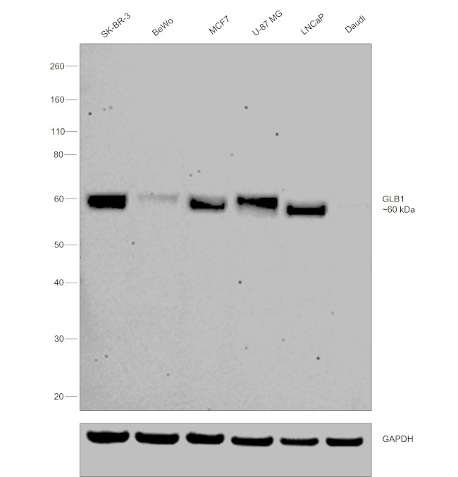 GLB1 Antibody in Western Blot (WB)