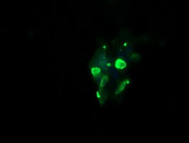 GLB1 Antibody in Immunocytochemistry (ICC/IF)