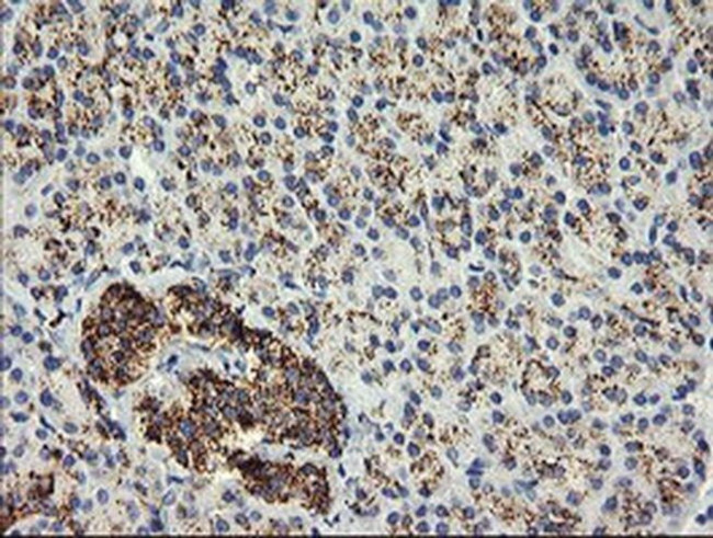 GLB1 Antibody in Immunohistochemistry (Paraffin) (IHC (P))