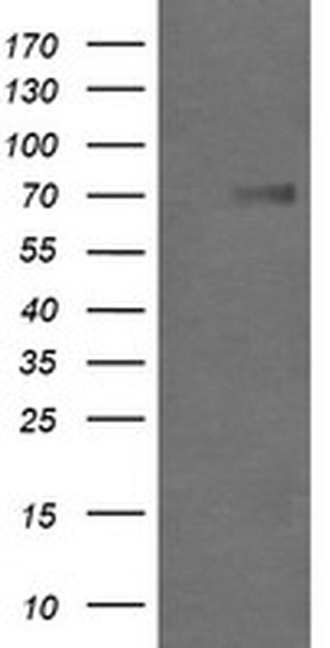 GLB1 Antibody in Western Blot (WB)