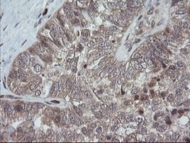 TRAPPC4 Antibody in Immunohistochemistry (Paraffin) (IHC (P))