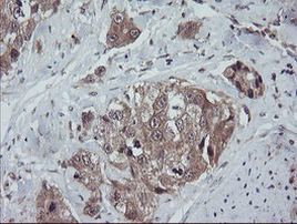 TRAPPC4 Antibody in Immunohistochemistry (Paraffin) (IHC (P))