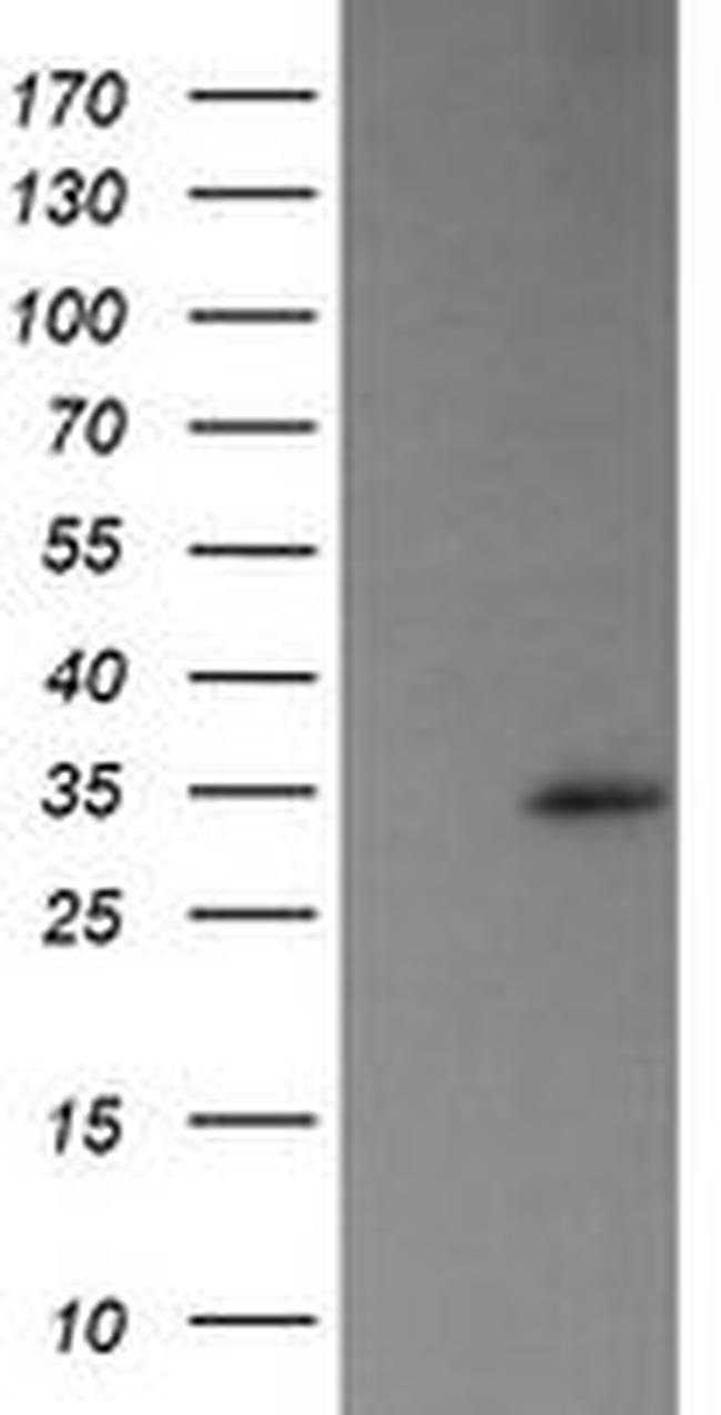 TRAPPC4 Antibody in Western Blot (WB)