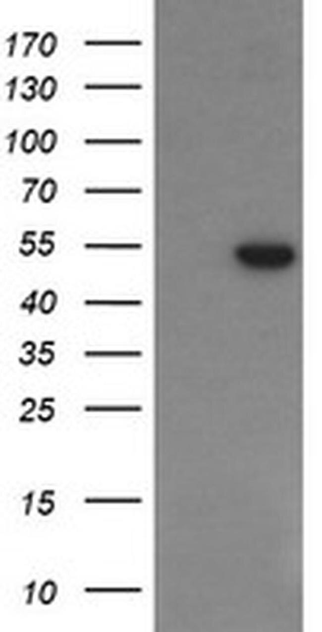 PGD Antibody in Western Blot (WB)