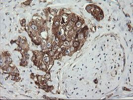 ROMO1 Antibody in Immunohistochemistry (Paraffin) (IHC (P))