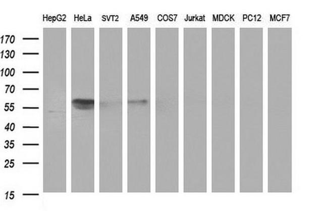 DIXDC1 Antibody in Western Blot (WB)