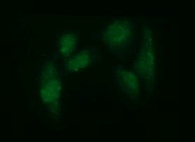 ADAMTS8 Antibody in Immunocytochemistry (ICC/IF)