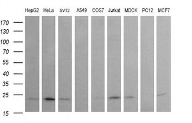 RAB24 Antibody in Western Blot (WB)