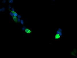 VPS28 Antibody in Immunocytochemistry (ICC/IF)