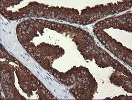 MDMX Antibody in Immunohistochemistry (Paraffin) (IHC (P))