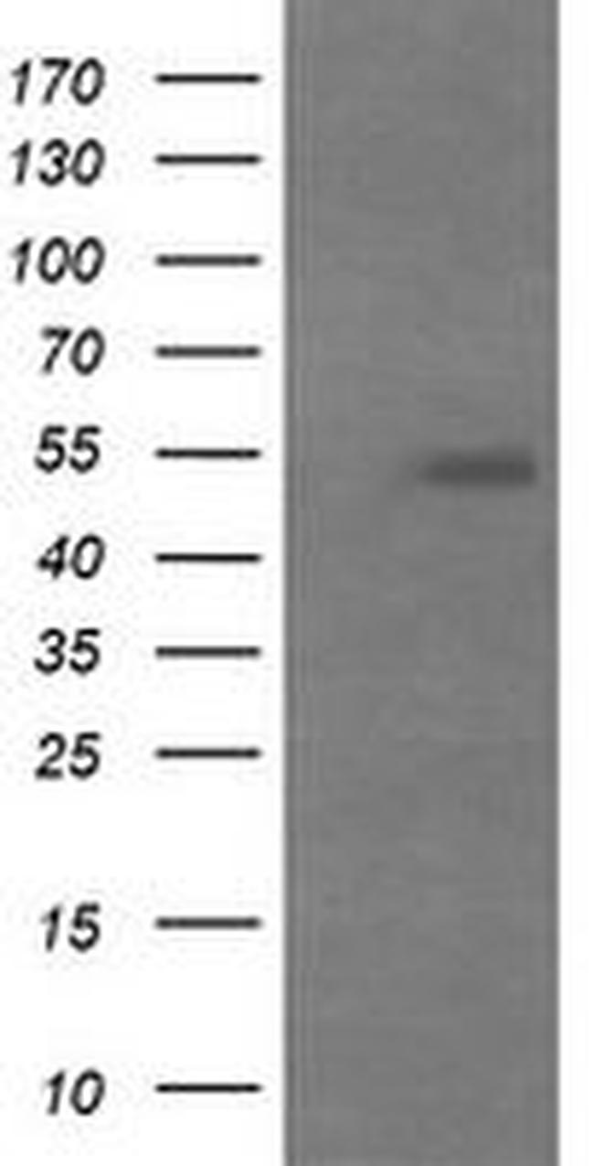 MDMX Antibody in Western Blot (WB)