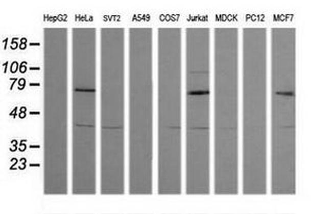 MDMX Antibody in Western Blot (WB)