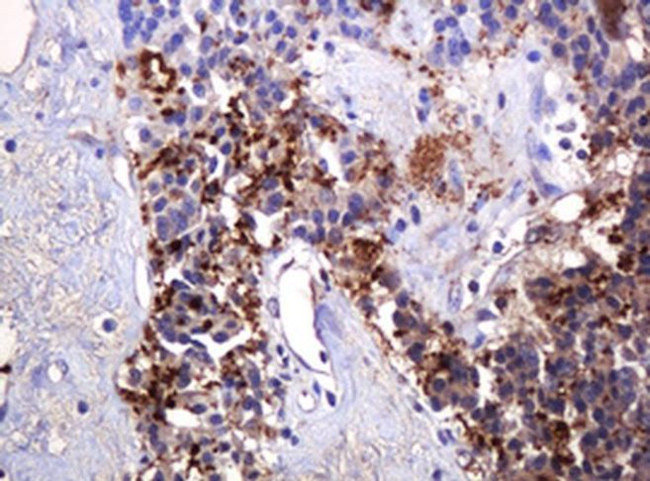 PARVB Antibody in Immunohistochemistry (Paraffin) (IHC (P))