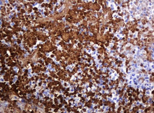 PARVB Antibody in Immunohistochemistry (Paraffin) (IHC (P))