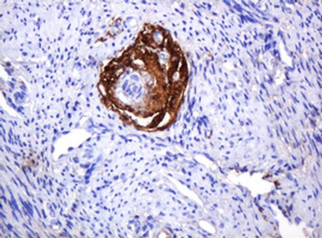 PARVB Antibody in Immunohistochemistry (Paraffin) (IHC (P))