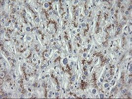 MDMX Antibody in Immunohistochemistry (Paraffin) (IHC (P))