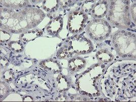 MDMX Antibody in Immunohistochemistry (Paraffin) (IHC (P))