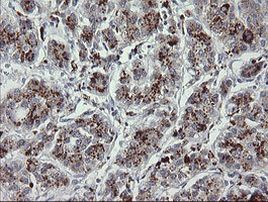 MDMX Antibody in Immunohistochemistry (Paraffin) (IHC (P))