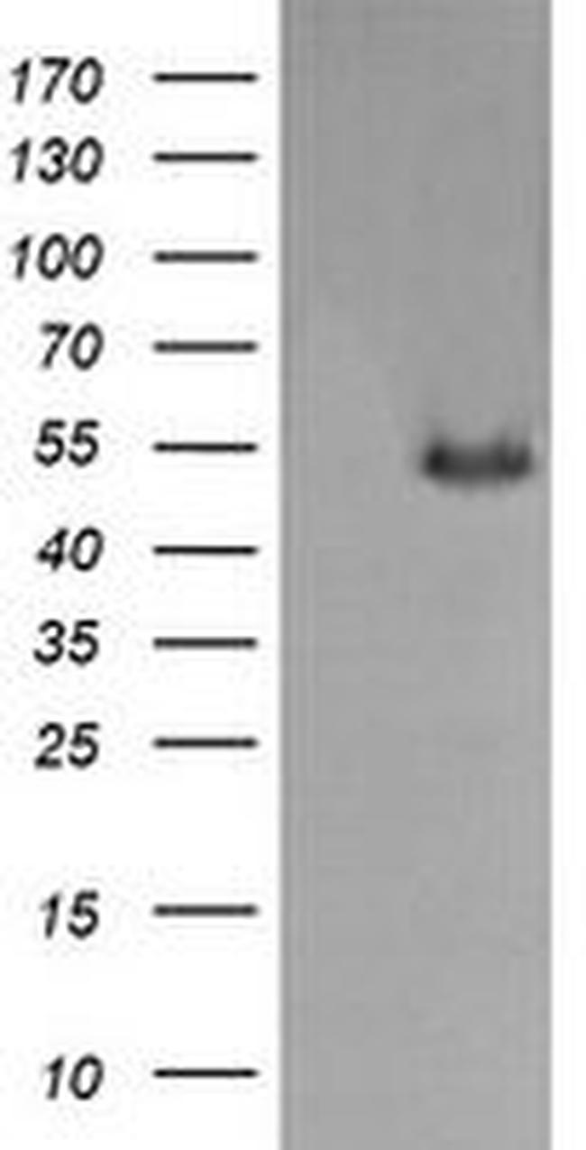 MDMX Antibody in Western Blot (WB)