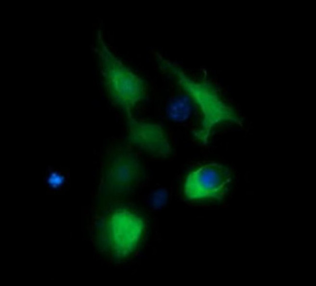 BBOX1 Antibody in Immunocytochemistry (ICC/IF)