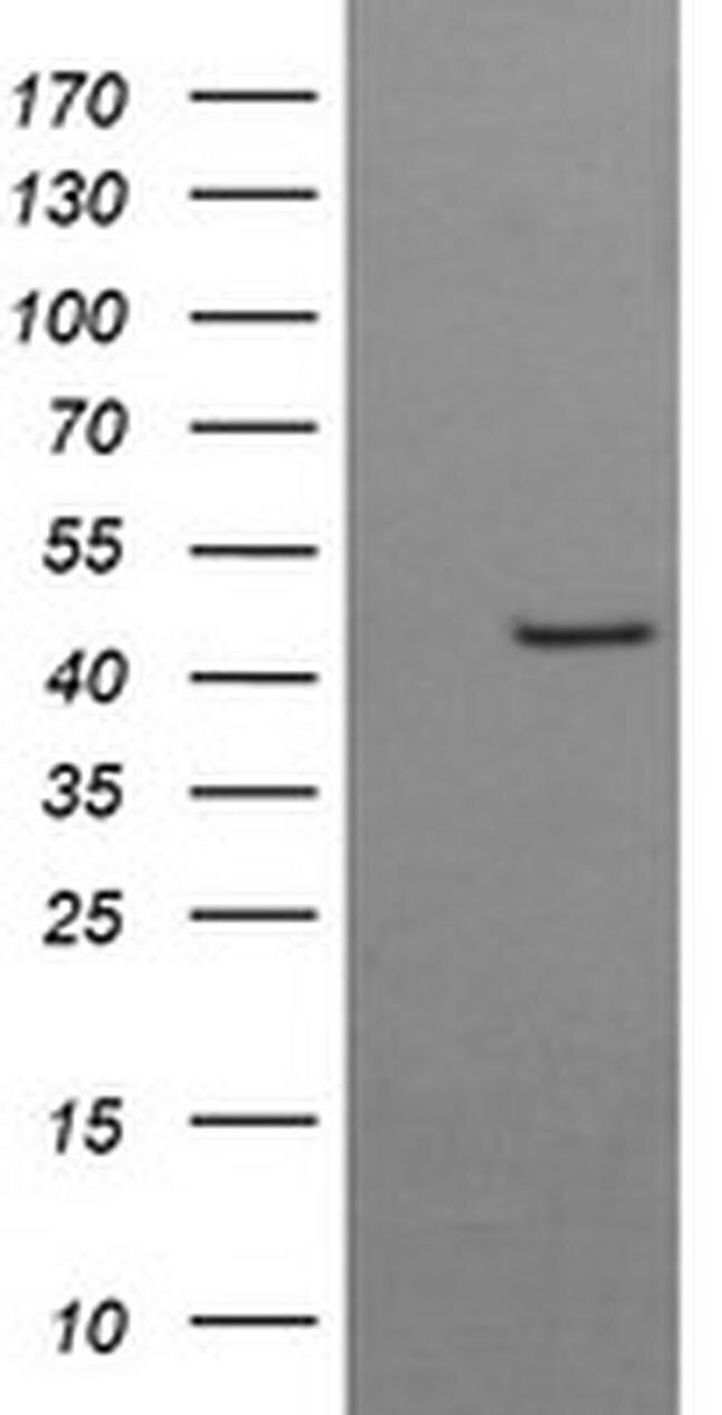 BBOX1 Antibody in Western Blot (WB)