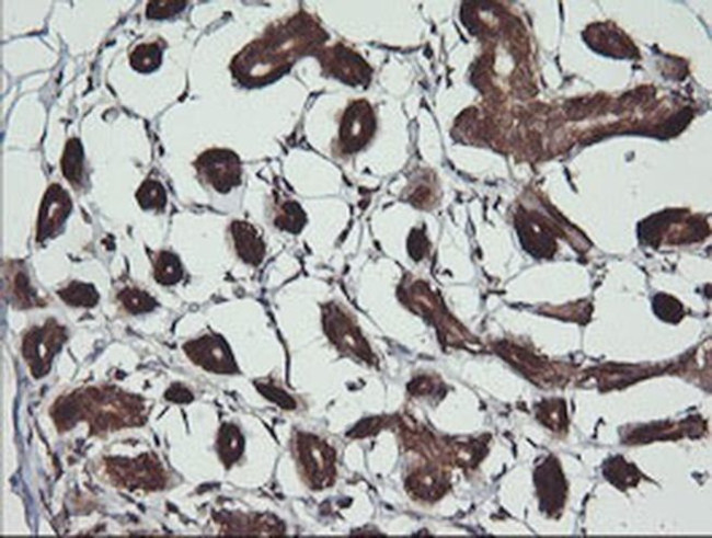 BBOX1 Antibody in Immunohistochemistry (Paraffin) (IHC (P))