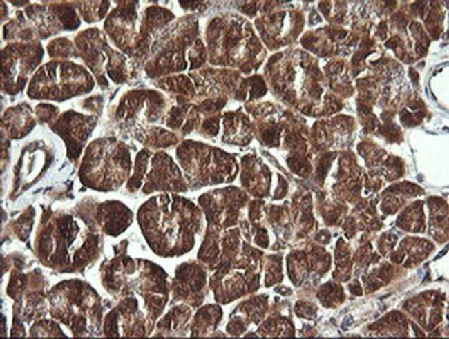 BBOX1 Antibody in Immunohistochemistry (Paraffin) (IHC (P))