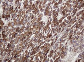 TBC1D13 Antibody in Immunohistochemistry (Paraffin) (IHC (P))