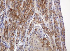 TBC1D13 Antibody in Immunohistochemistry (Paraffin) (IHC (P))